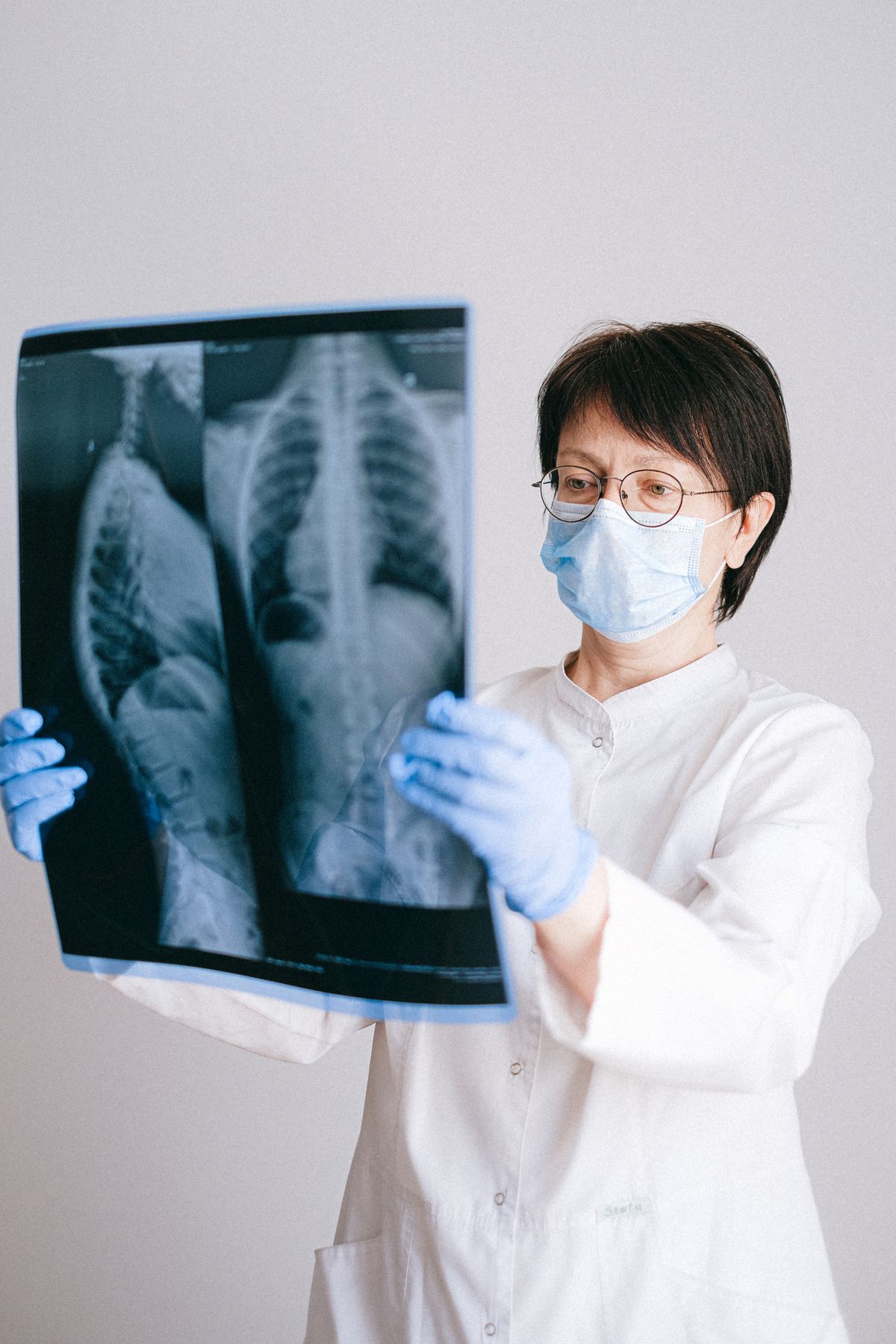 Digital X-Ray